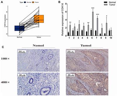 Endometrial cancer prognosis prediction using correlation models based on CDK family genes